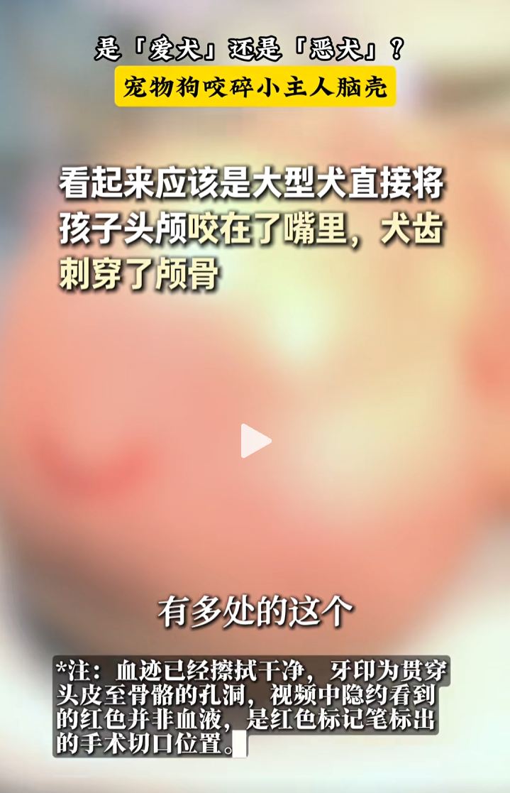 12.png