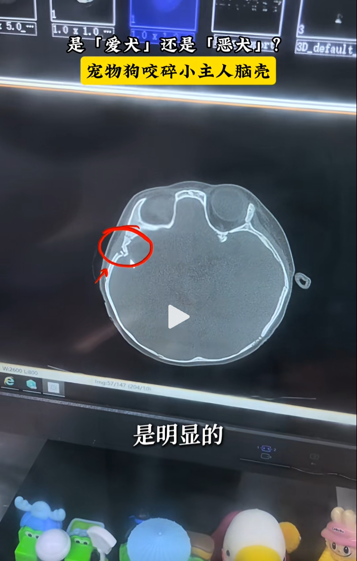 14.png