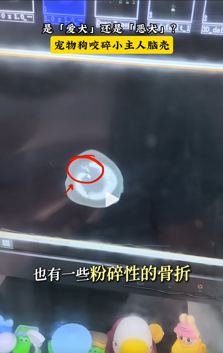 18.png