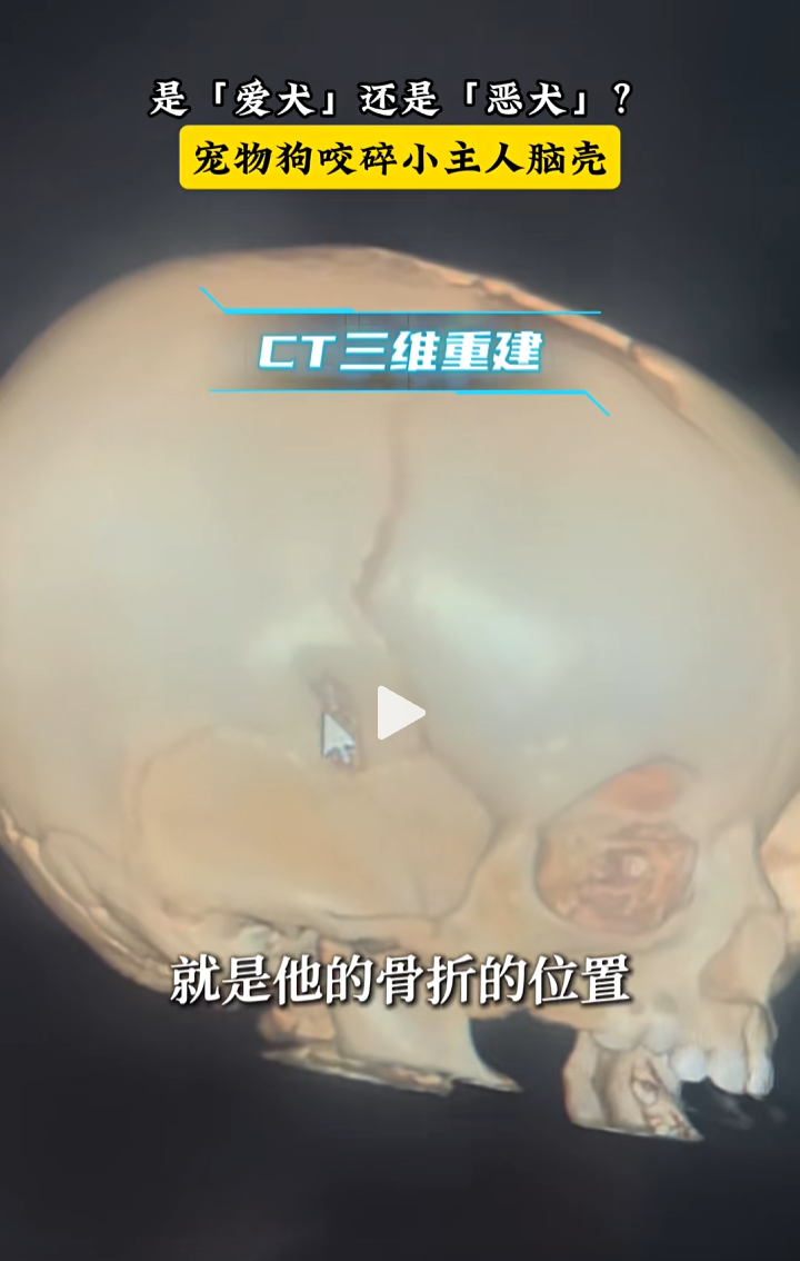 19.png